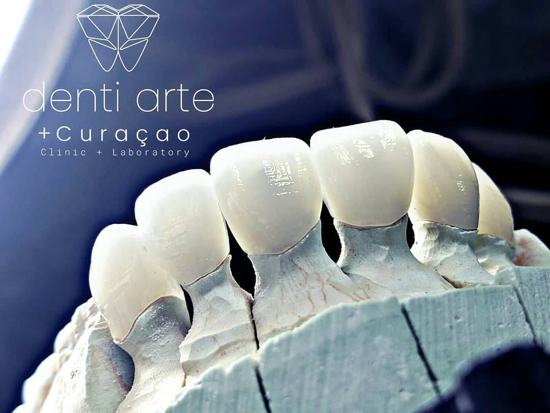 Denti Arte Curacao